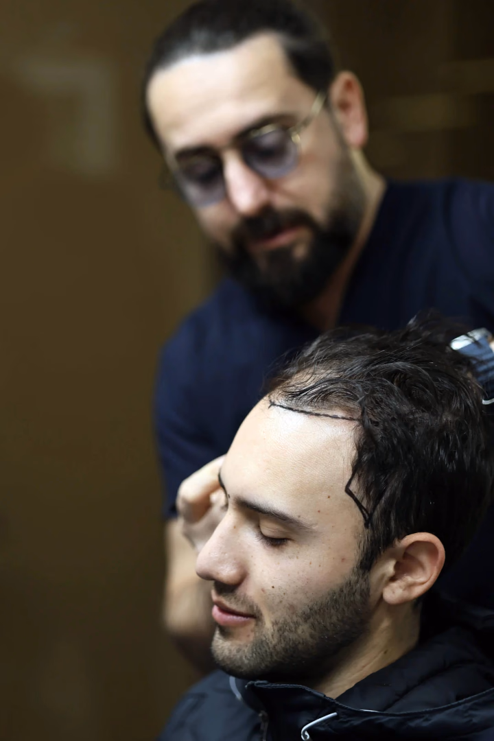 Hairline assessment during a consultation