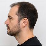 Example angle: Left profile