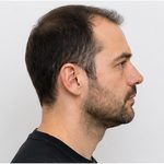 Example angle: Right profile
