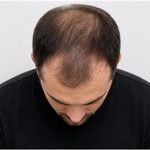 Example angle: Top of the head