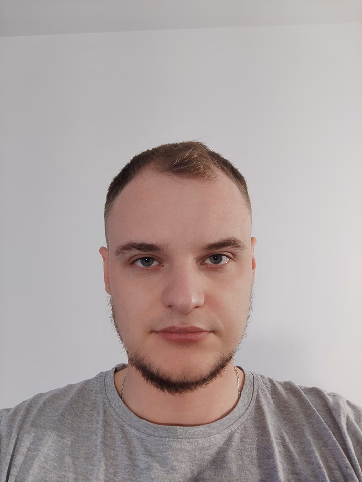 Before hair transplantation, comparison 03