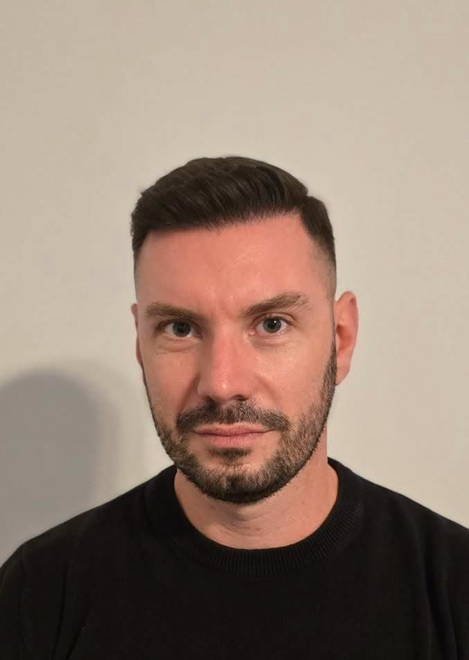 After hair transplantation, comparison 10